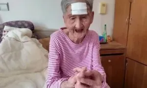 Tự cắt 'sừng' trên trán, người phụ nữ suýt chết